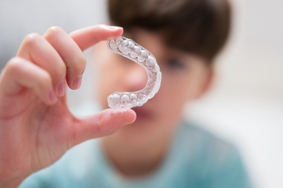 Çocuklarda Şeffaf Plaklarla Ortodonti